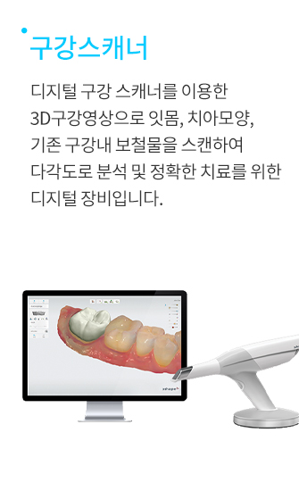 구강스캐너