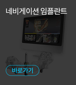 네비게이션 임플란트